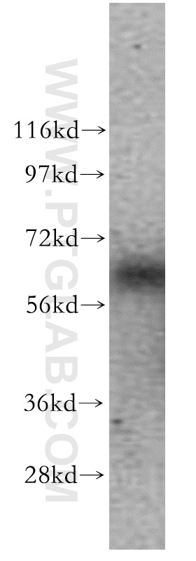 WB analysis of mouse brain using 10173-1-AP