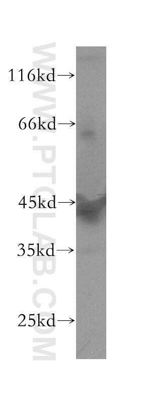 Western Blot (WB) analysis of K-562 cells using GTF2H2 Polyclonal antibody (16005-1-AP)