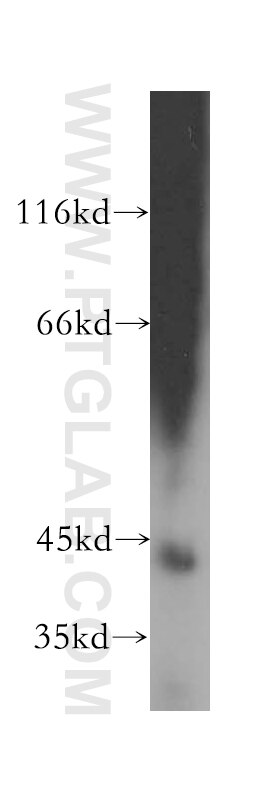 Western Blot (WB) analysis of K-562 cells using GTF2H2 Polyclonal antibody (16005-1-AP)