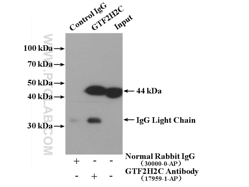 Immunoprecipitation (IP) experiment of HepG2 cells using GTF2H2C Polyclonal antibody (17959-1-AP)