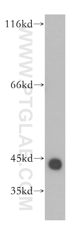 Western Blot (WB) analysis of HepG2 cells using GTF2H2C Polyclonal antibody (17959-1-AP)