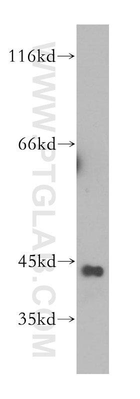 Western Blot (WB) analysis of HeLa cells using GTF2H2C Polyclonal antibody (17959-1-AP)