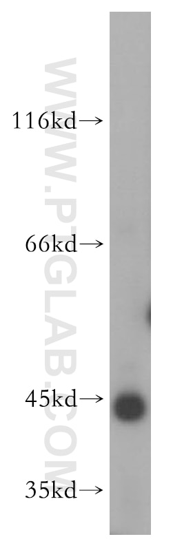 Western Blot (WB) analysis of MCF-7 cells using GTF2H2C Polyclonal antibody (17959-1-AP)