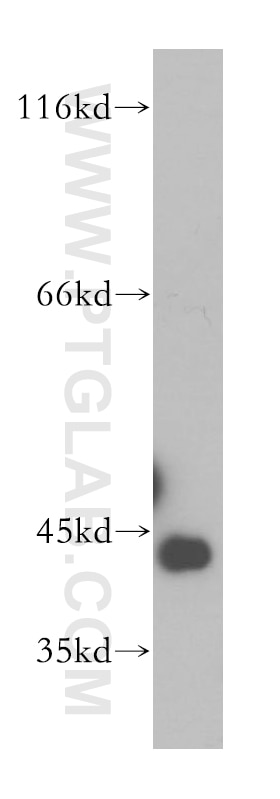Western Blot (WB) analysis of K-562 cells using GTF2H2C Polyclonal antibody (17959-1-AP)