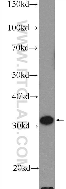 Western Blot (WB) analysis of K-562 cells using GTF2H3 Polyclonal antibody (19869-1-AP)
