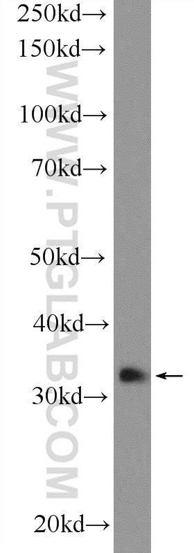 Western Blot (WB) analysis of HepG2 cells using GTF2H3 Polyclonal antibody (19869-1-AP)