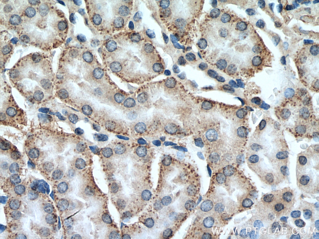 IHC staining of mouse kidney using 29112-1-AP Immunohistochemistry (IHC) staining of mouse kidney tissue using GTF2H5 Polyclonal antibody (29112-1-AP)