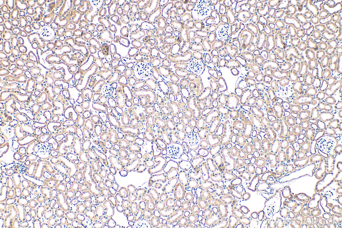 IHC staining of mouse kidney using 29112-1-AP Immunohistochemistry (IHC) staining of mouse kidney tissue using GTF2H5 Polyclonal antibody (29112-1-AP)