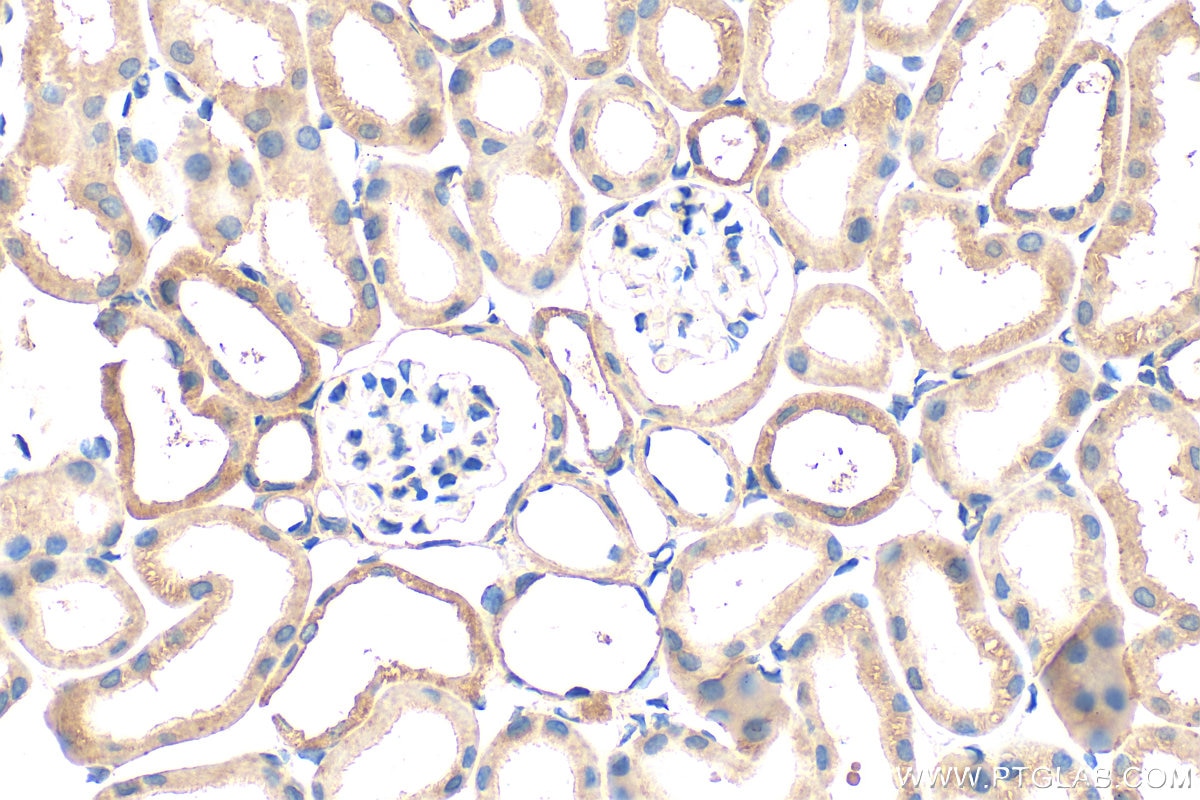 IHC staining of mouse kidney using 29112-1-AP Immunohistochemistry (IHC) staining of mouse kidney tissue using GTF2H5 Polyclonal antibody (29112-1-AP)