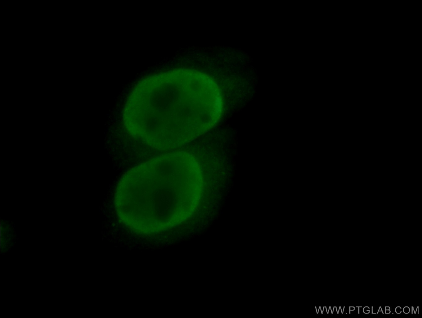 Immunofluorescence (IF) / fluorescent staining of HeLa cells using TFII I Polyclonal antibody (10499-1-AP)