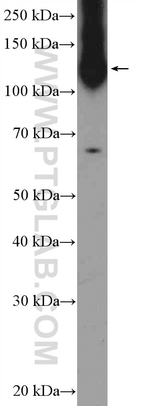 Western Blot (WB) analysis of HEK-293 cells using TFII I Polyclonal antibody (10499-1-AP)