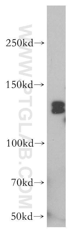 Western Blot (WB) analysis of HeLa cells using TFII I Polyclonal antibody (10499-1-AP)