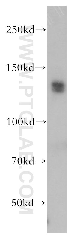 Western Blot (WB) analysis of Jurkat cells using TFII I Polyclonal antibody (10499-1-AP)