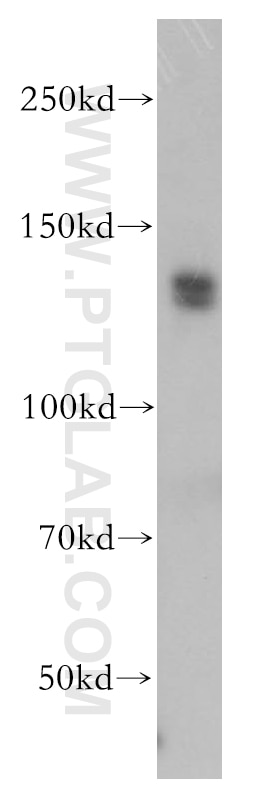 Western Blot (WB) analysis of Jurkat cells using TFII I Polyclonal antibody (10499-1-AP)