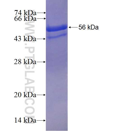 GTF2I fusion protein Ag0773 SDS-PAGE