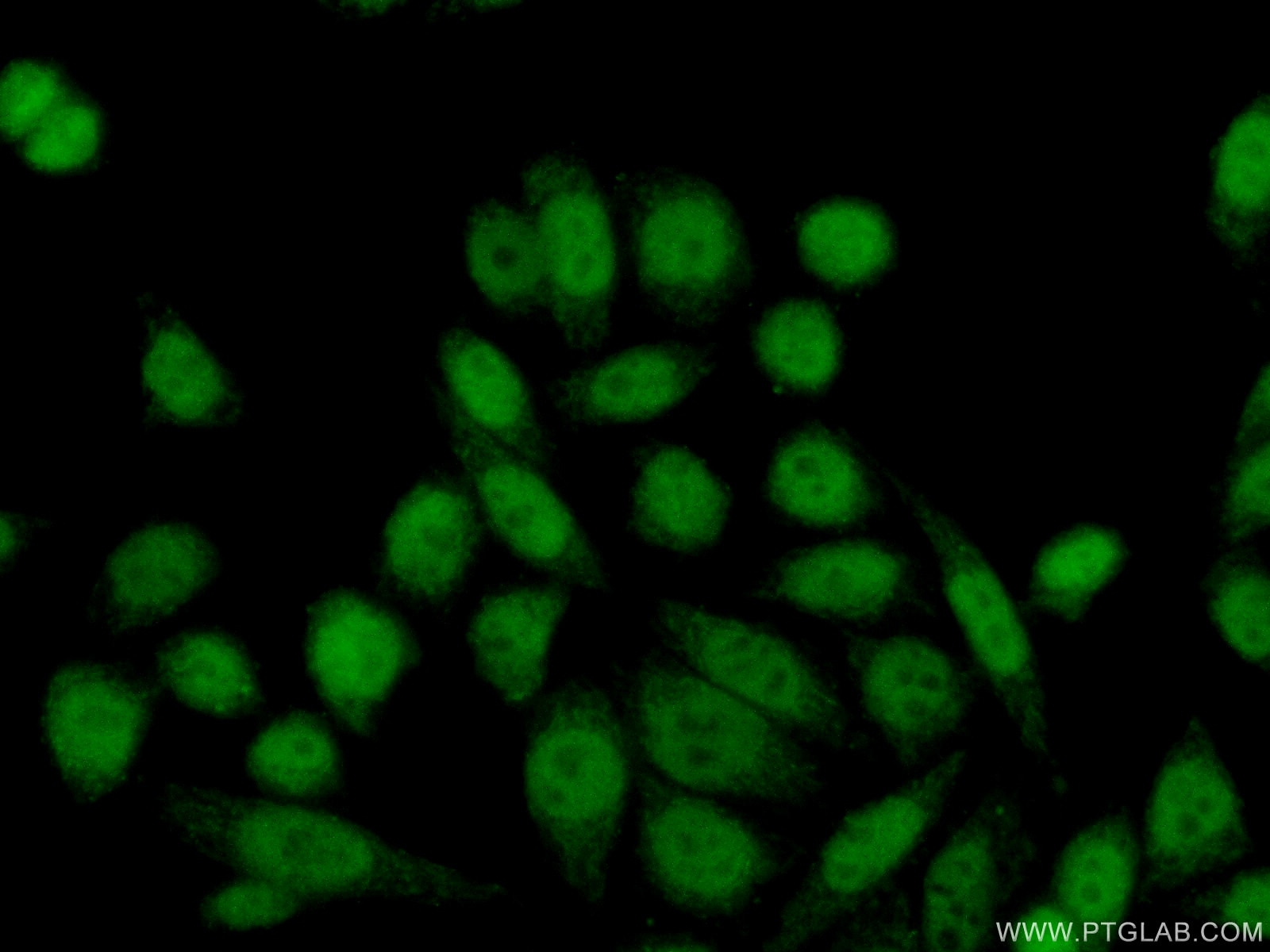 Immunofluorescence (IF) / fluorescent staining of HeLa cells using GTF2IRD1 Polyclonal antibody (17052-1-AP)