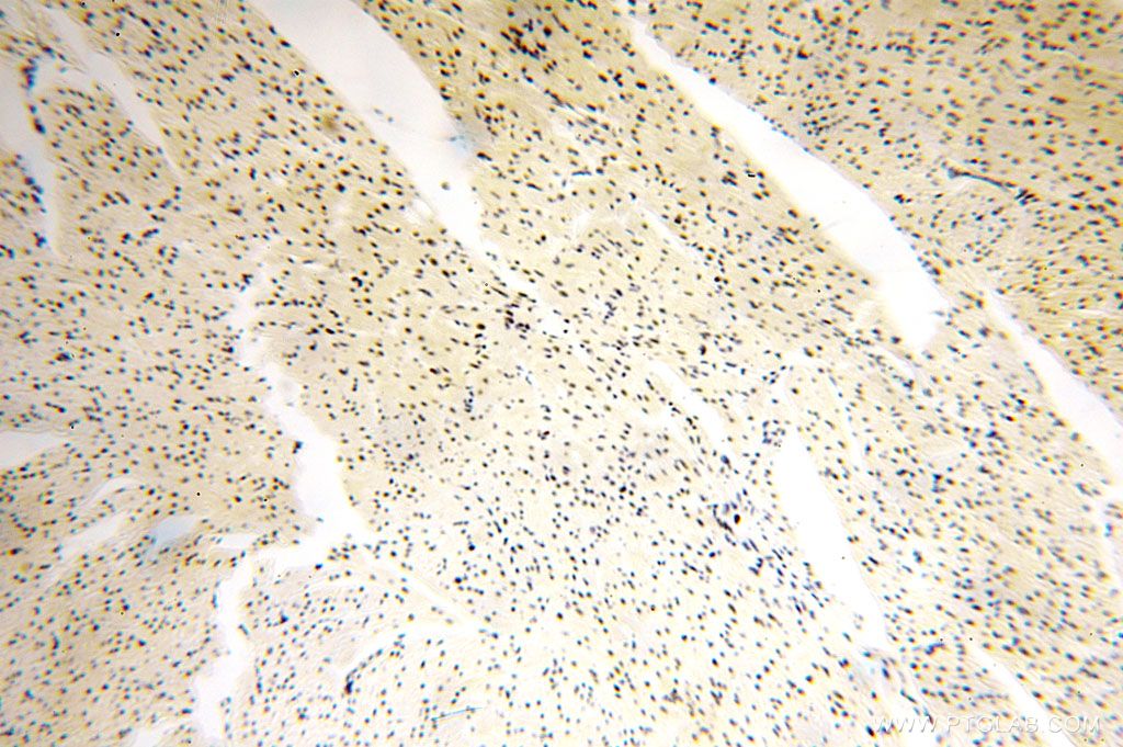 Immunohistochemistry (IHC) staining of human heart tissue using GTF2IRD1 Polyclonal antibody (17052-1-AP)