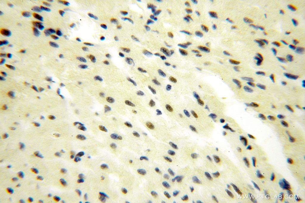 IHC staining of human heart using 17052-1-AP