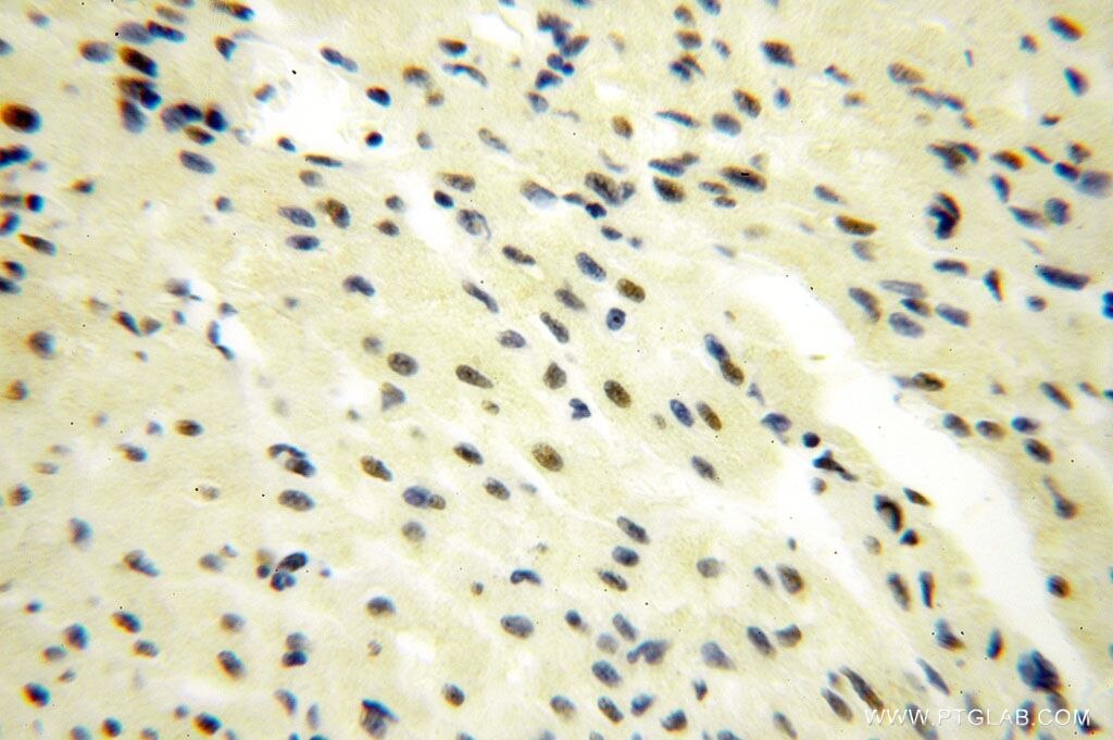 Immunohistochemistry (IHC) staining of human heart tissue using GTF2IRD1 Polyclonal antibody (17052-1-AP)