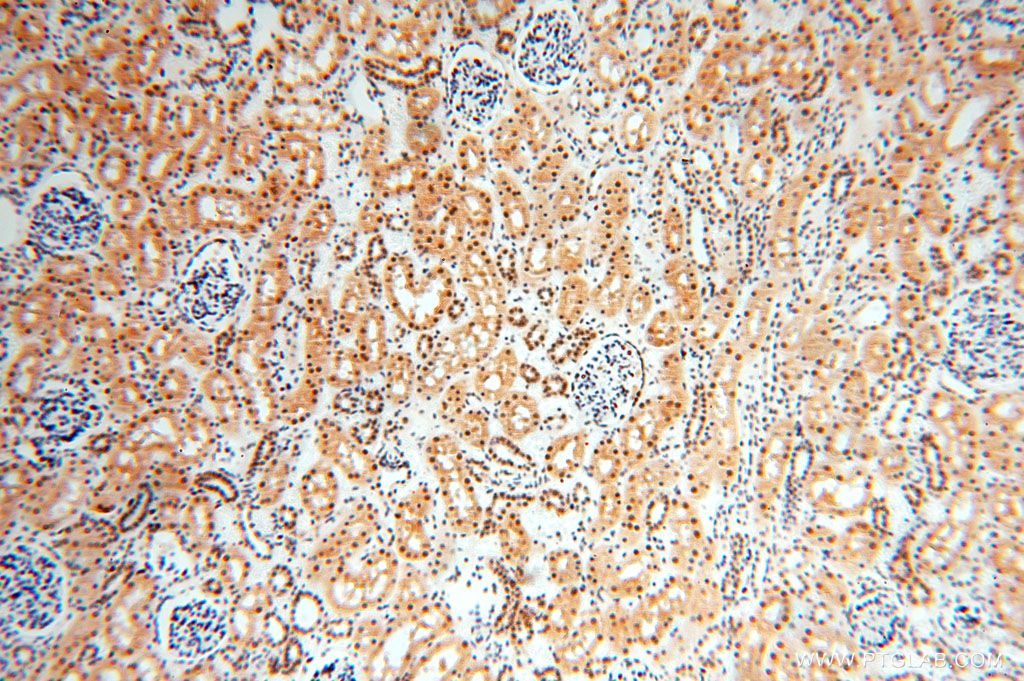 Immunohistochemistry (IHC) staining of human kidney tissue using GTF2IRD1 Polyclonal antibody (17052-1-AP)