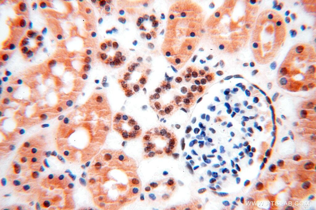 Immunohistochemistry (IHC) staining of human kidney tissue using GTF2IRD1 Polyclonal antibody (17052-1-AP)