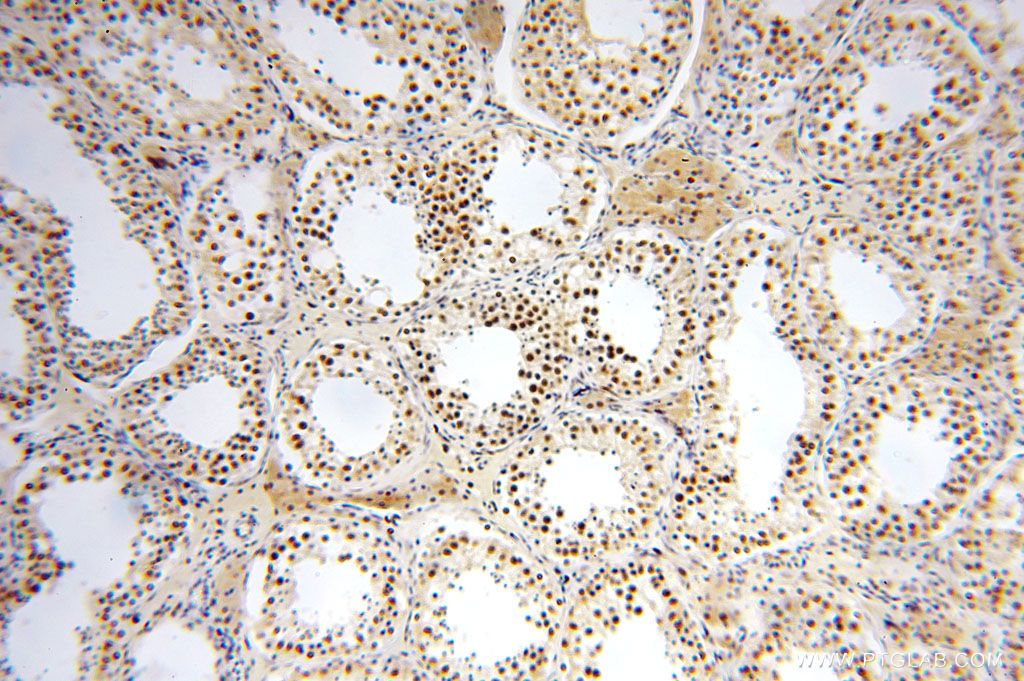 Immunohistochemistry (IHC) staining of human testis tissue using GTF2IRD1 Polyclonal antibody (17052-1-AP)