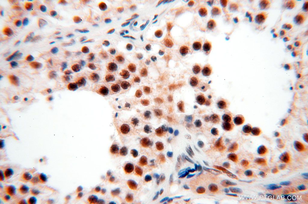 IHC staining of human testis using 17052-1-AP
