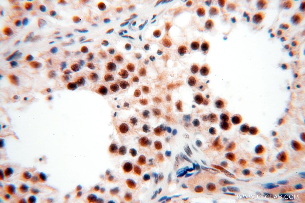 Immunohistochemistry (IHC) staining of human testis tissue using GTF2IRD1 Polyclonal antibody (17052-1-AP)