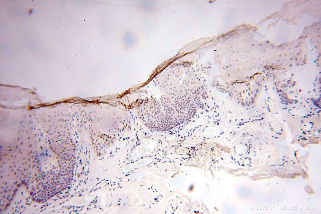 Immunohistochemistry (IHC) staining of human skin tissue using GTF2IRD1 Polyclonal antibody (17052-1-AP)