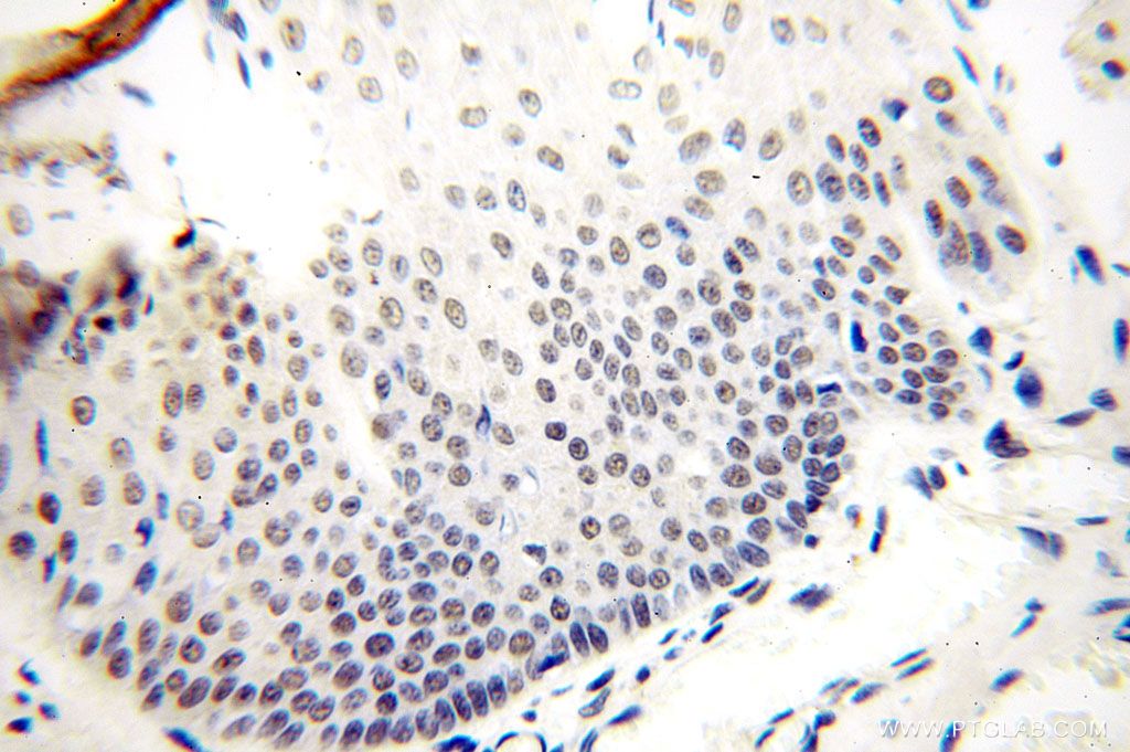 Immunohistochemistry (IHC) staining of human skin tissue using GTF2IRD1 Polyclonal antibody (17052-1-AP)
