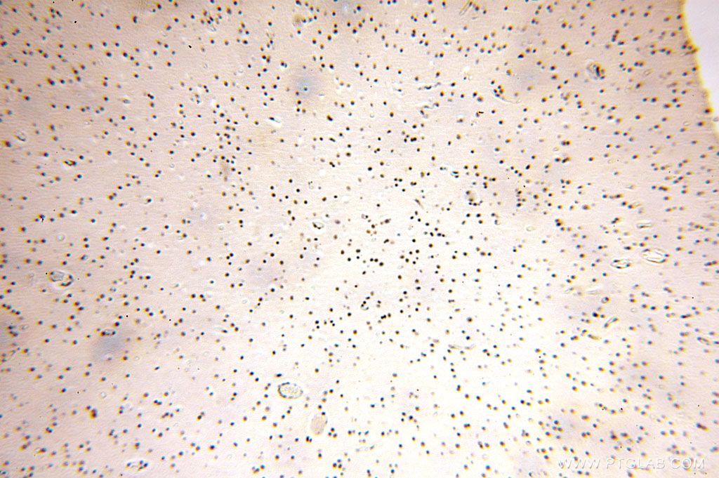 Immunohistochemistry (IHC) staining of human brain tissue using GTF2IRD1 Polyclonal antibody (17052-1-AP)