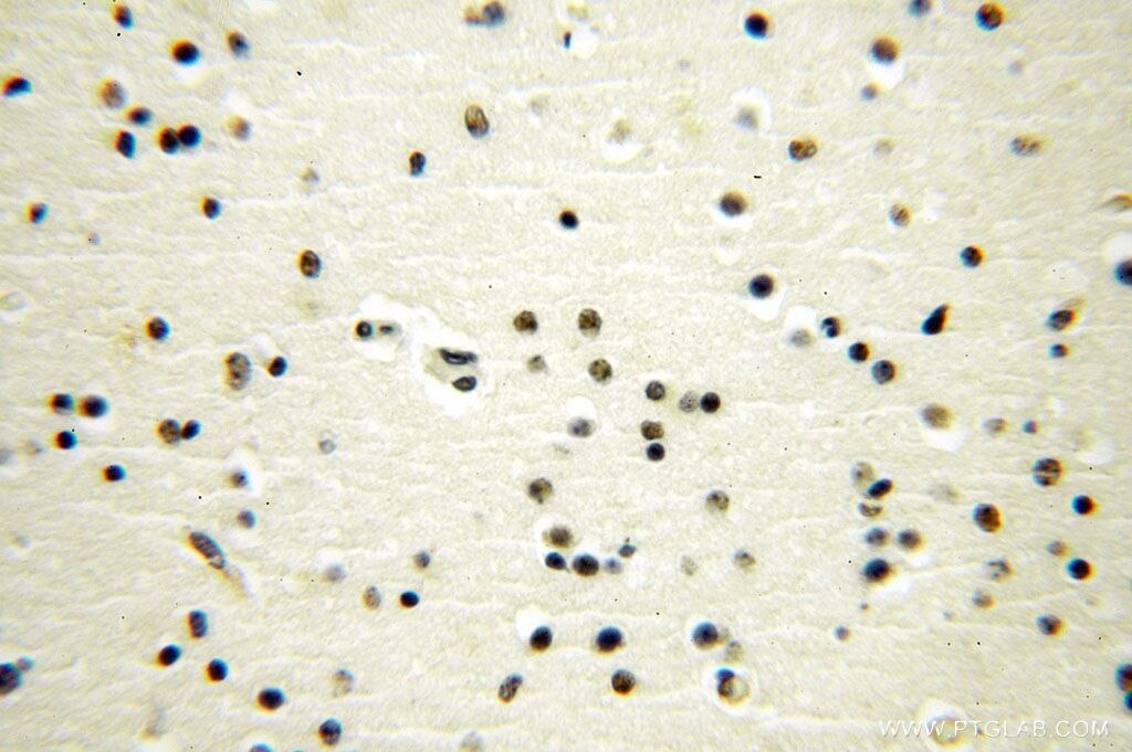 Immunohistochemistry (IHC) staining of human brain tissue using GTF2IRD1 Polyclonal antibody (17052-1-AP)