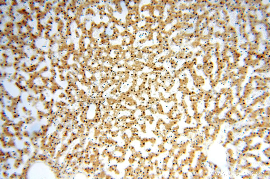 Immunohistochemistry (IHC) staining of human liver tissue using GTF2IRD1 Polyclonal antibody (17052-1-AP)