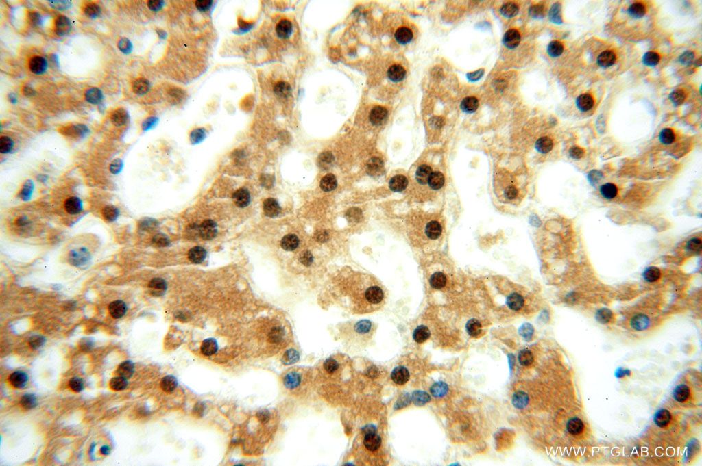 Immunohistochemistry (IHC) staining of human liver tissue using GTF2IRD1 Polyclonal antibody (17052-1-AP)