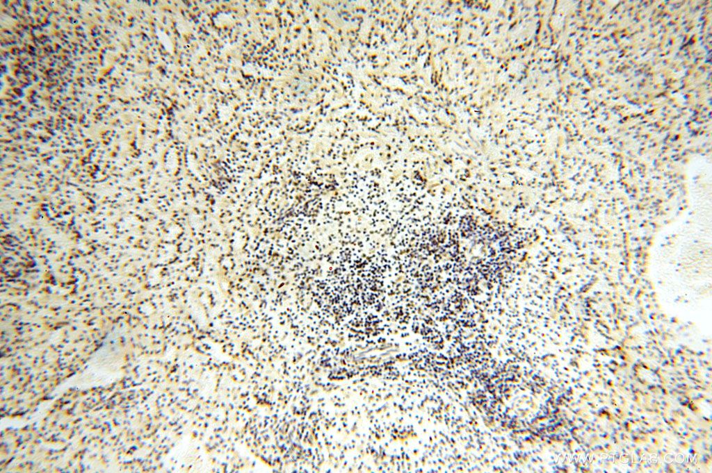 Immunohistochemistry (IHC) staining of human spleen tissue using GTF2IRD1 Polyclonal antibody (17052-1-AP)