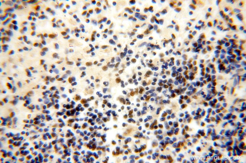 Immunohistochemistry (IHC) staining of human spleen tissue using GTF2IRD1 Polyclonal antibody (17052-1-AP)