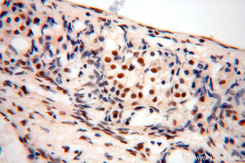 Immunohistochemistry (IHC) staining of human ovary tissue using GTF2IRD1 Polyclonal antibody (17052-1-AP)