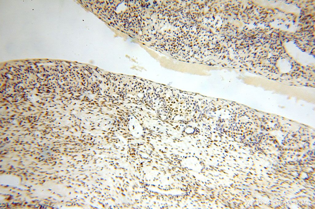 Immunohistochemistry (IHC) staining of human ovary tissue using GTF2IRD1 Polyclonal antibody (17052-1-AP)