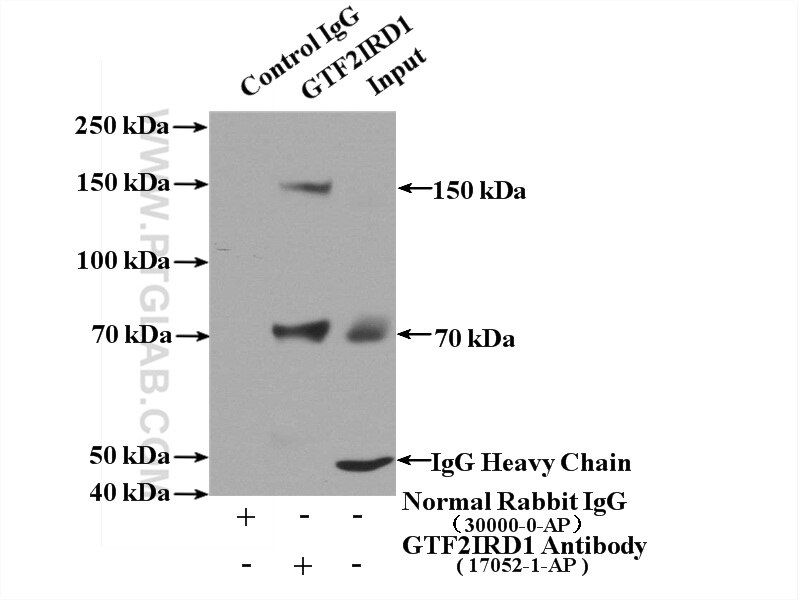 Immunoprecipitation (IP) experiment of mouse liver tissue using GTF2IRD1 Polyclonal antibody (17052-1-AP)