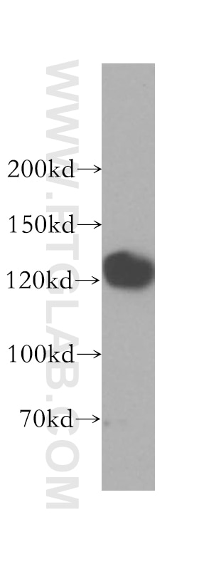 Western Blot (WB) analysis of HeLa cells using GTF2IRD1 Polyclonal antibody (17052-1-AP)