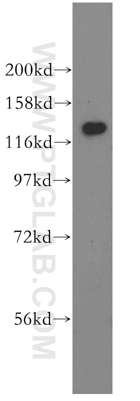 Western Blot (WB) analysis of mouse liver tissue using GTF2IRD1 Polyclonal antibody (17052-1-AP)