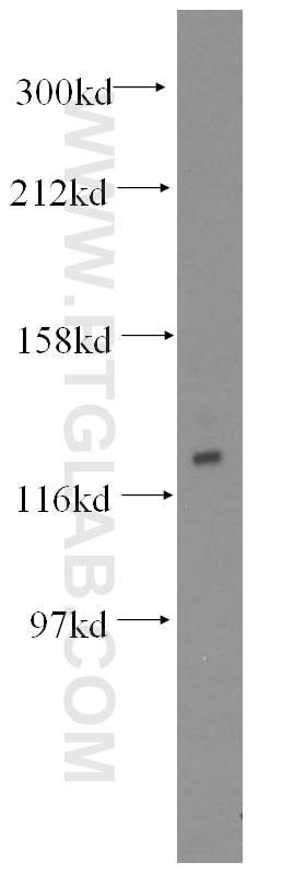 Western Blot (WB) analysis of mouse brain tissue using GTF2IRD1 Polyclonal antibody (17052-1-AP)