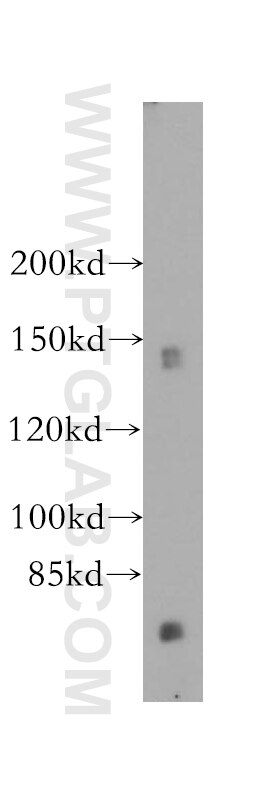 Western Blot (WB) analysis of mouse kidney tissue using GTF2IRD1 Polyclonal antibody (17052-1-AP)