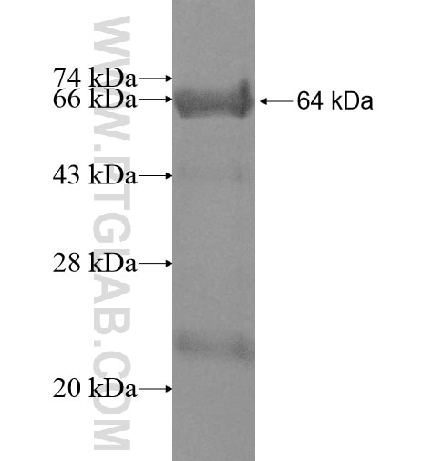 GTF2IRD1 fusion protein Ag10718 SDS-PAGE