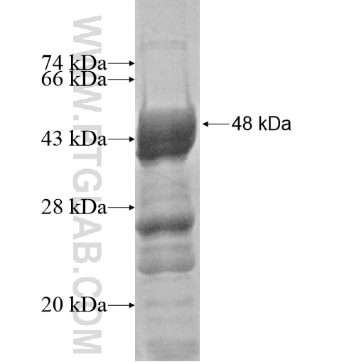 GTF2IRD1 fusion protein Ag10761 SDS-PAGE