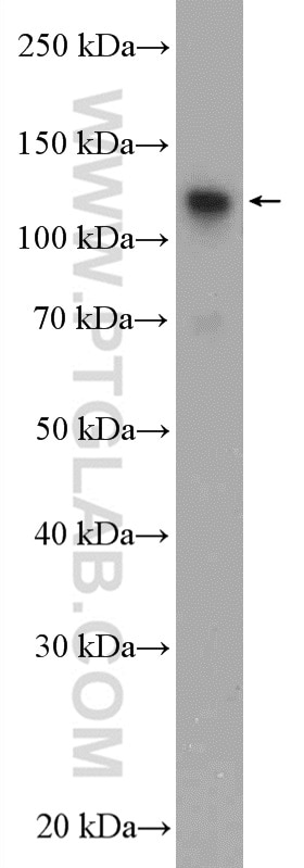 Western Blot (WB) analysis of A549 cells using GTF3C2 Polyclonal antibody (27494-1-AP)