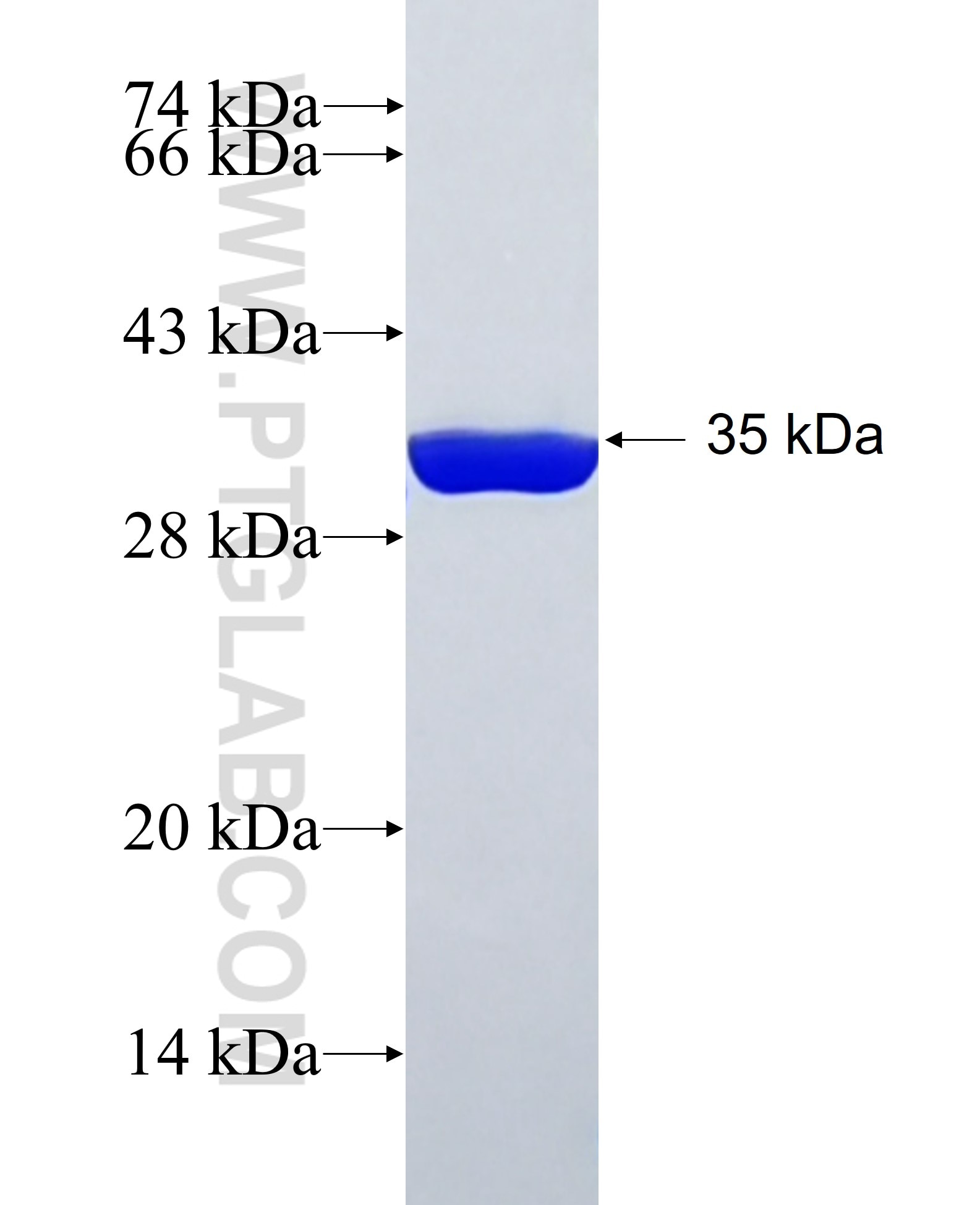 GTF3C3 fusion protein Ag38449 SDS-PAGE GTF3C3 fusion protein Ag38449 SDS-PAGE