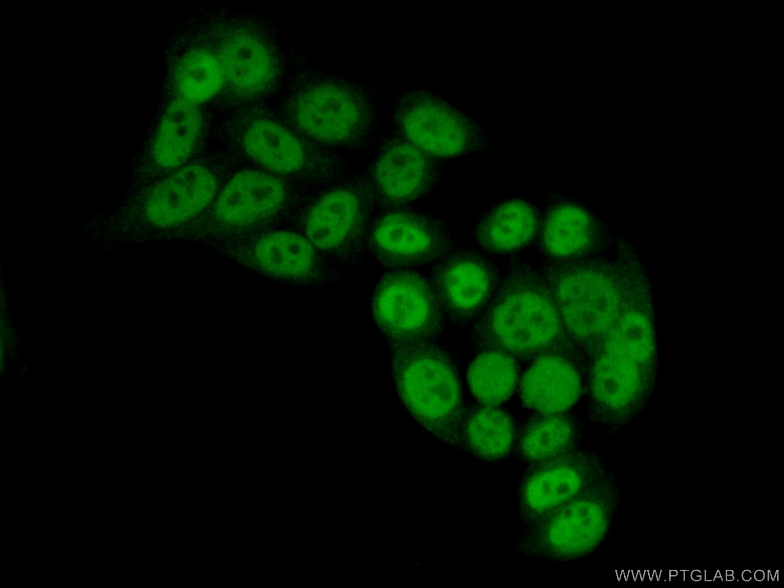 Immunofluorescence (IF) / fluorescent staining of HeLa cells using GTF3C4 Polyclonal antibody (17653-1-AP)