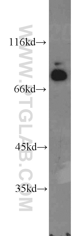 Western Blot (WB) analysis of HeLa cells using GTF3C4 Polyclonal antibody (17653-1-AP)