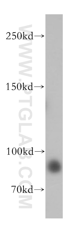 Western Blot (WB) analysis of HeLa cells using GTF3C4 Polyclonal antibody (17653-1-AP)